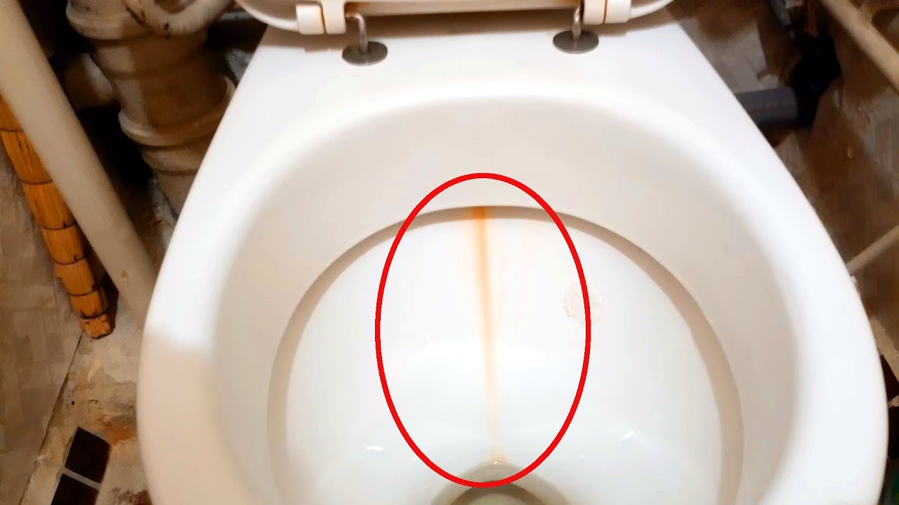 Alumiinifoliopakkaus muuttuu kotitalouden aseeksi: tämä villi temppu puhdistaa wc:t ja poistaa kalkkikiven tehokkaasti